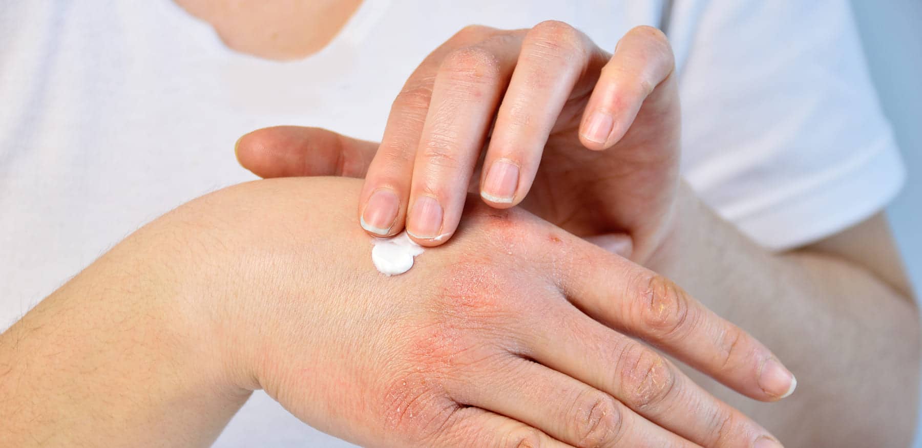 Dehydrierte Haut? Mit diesen 5 Pflege-Tipps bringst du sie wieder zum Strahlen!