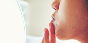 Pickelmale entfernen: Diese Tipps & Wirkstoffe helfen gegen dunkle Flecken!