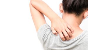 Trockene Haut: Was fehlt dem Körper? Ursachen, Tipps & richtige Pflege