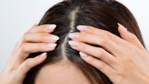 Haarausfall: Das sind die häufigsten Ursachen und Arten