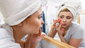 Mitesser endlich loswerden: 4 Tipps für deine Pflegeroutine!