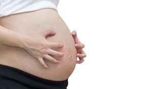 Juckreiz in der Schwangerschaft: Was dir jetzt guttut!