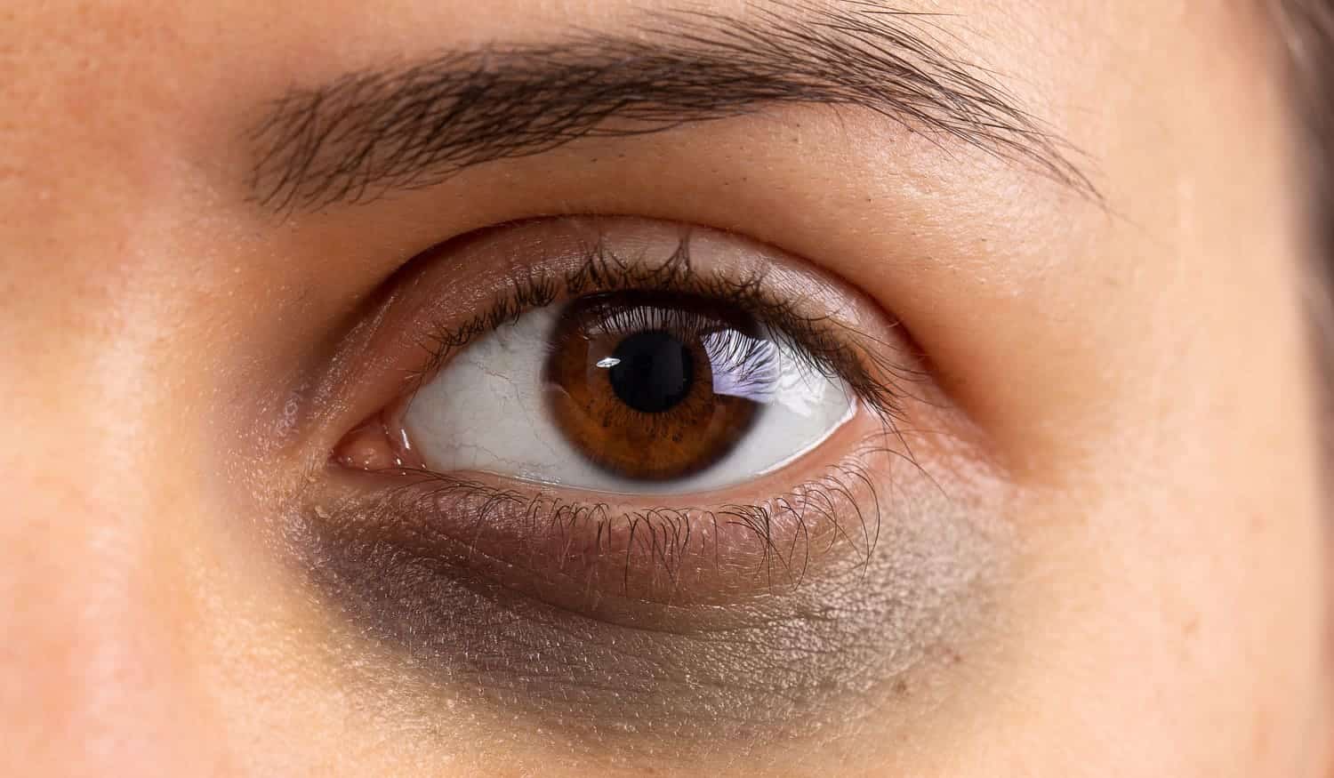 Dunkle Augenringe? Ursachen, Tipps und die richtige Gesichtspflege