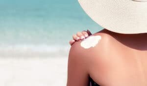 Creme gegen Sonnenbrand: Welche After Sun Pflege deine Haut jetzt braucht!