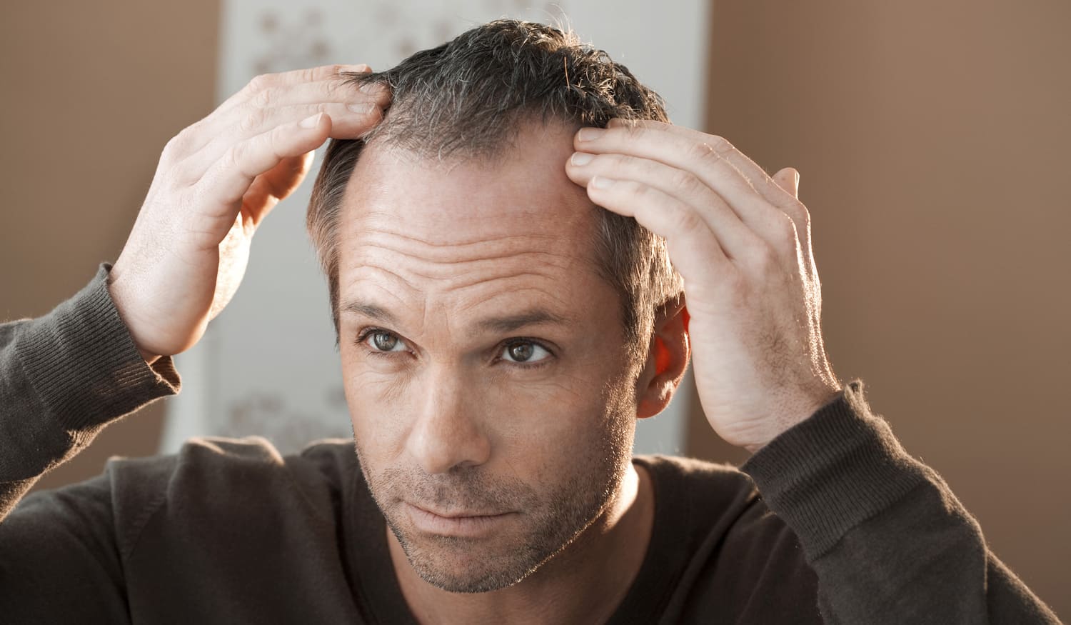 Das sind die häufigsten Ursachen für Haarausfall bei Männern – und so kannst du sie behandeln