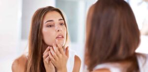 Warum Pickel vor der Periode kommen - und was du dagegen tun kannst