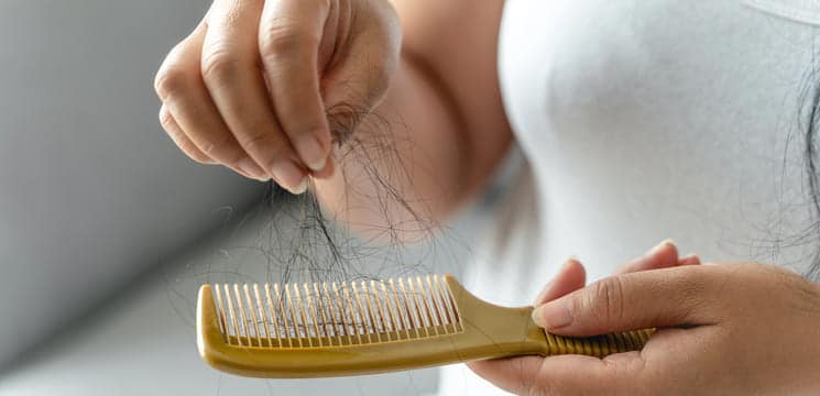 Frau mit Haarausfall.