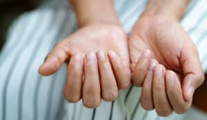 Brüchige Fingernägel in den Wechseljahren: Ursachen, Tipps und was wirklich hilft